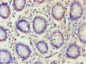 DNA-binding protein inhibitor ID-2 antibody