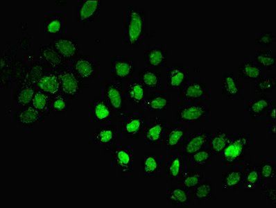 DNA ligase 1 antibody