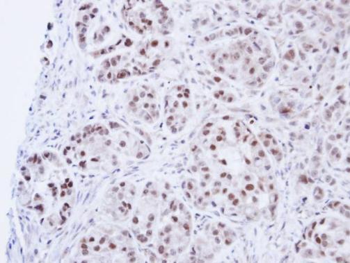 DNA ligase III antibody