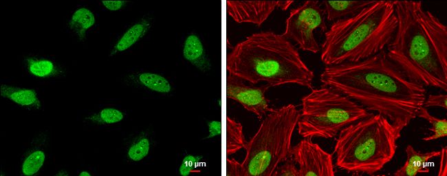 RanBP1 antibody