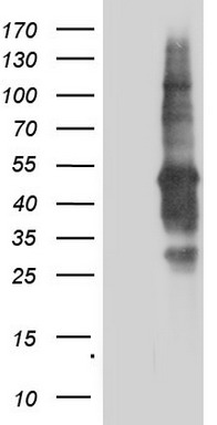 DNA Polymerase iota Antibody