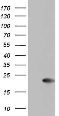 DNA Polymerase iota Antibody