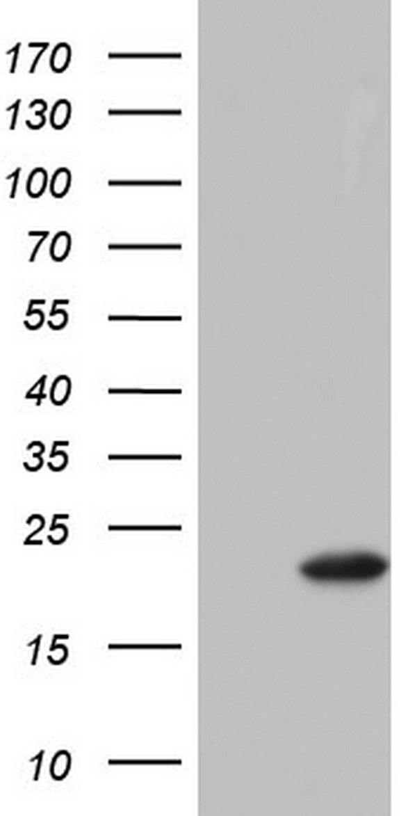 DNA Polymerase iota Antibody