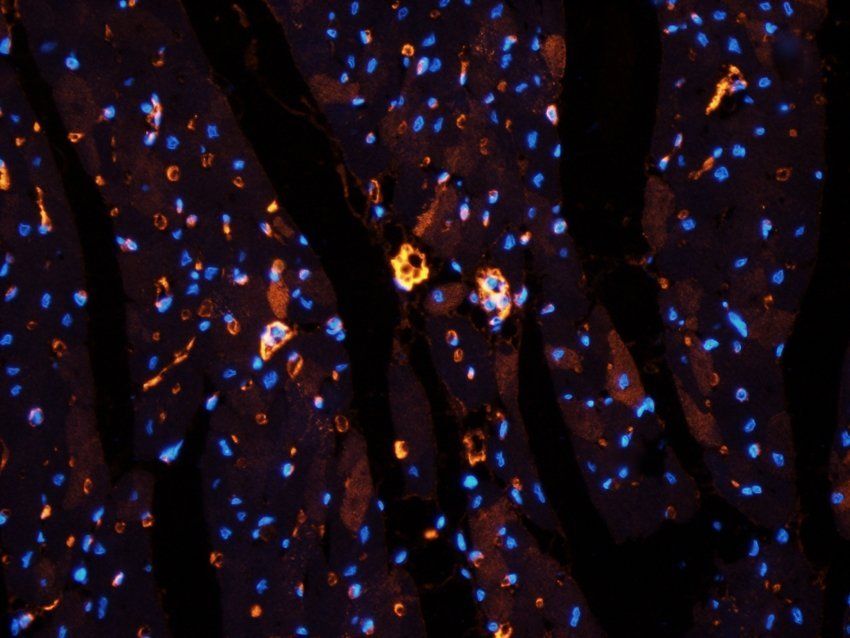 DNA polymerase theta antibody