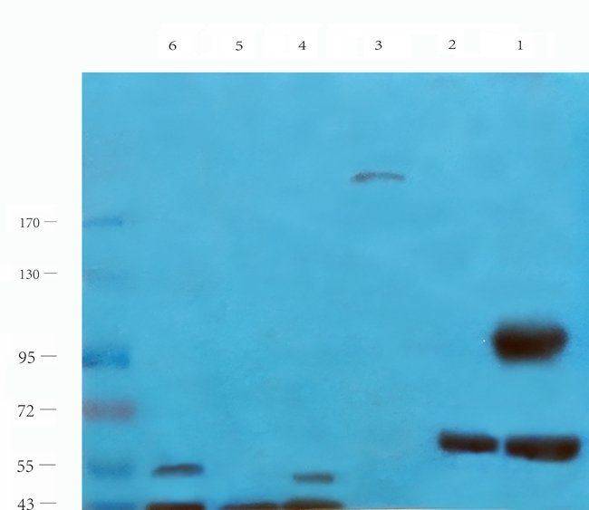 DNA polymerase theta antibody