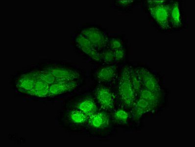 POLH antibody