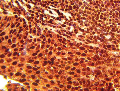 Rabbit Human DNA Topoisomerase 1 Antibody