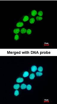 DNA ligase 3 antibody