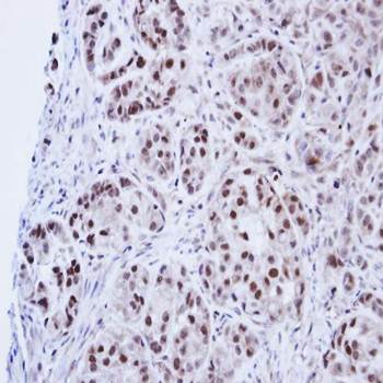 DNA ligase 3 antibody