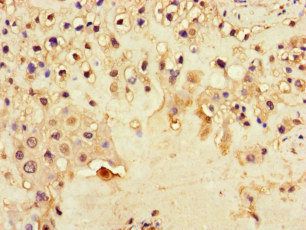 DNAH1 Antibody