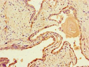 DNAH1 Antibody
