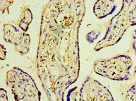DNAH3 Antibody