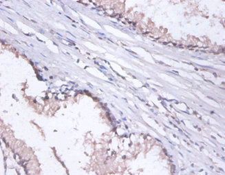 DNAJB1 Antibody