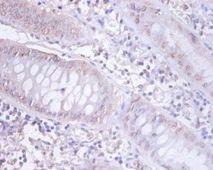 DnaJ homolog subfamily B member 1 antibody