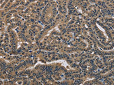 DNAJA1 Antibody