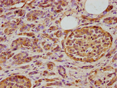 DNAJA3 Antibody