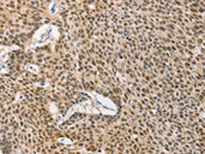 DNAJB1 Antibody