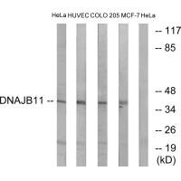 DNAJB11 antibody