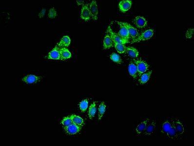 DNAJB11 antibody