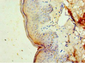 DNAJB2 Antibody