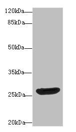 DNAJB2 Antibody