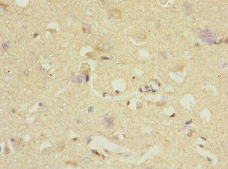 DNAJB2 Antibody