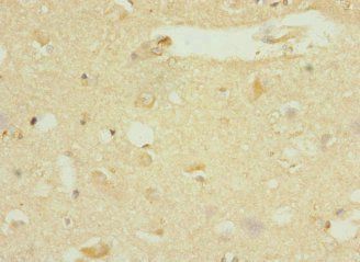 DNAJB2 Antibody