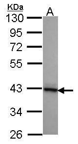 DnaJ heat shock protein family (Hsp40) member B2 Antibody