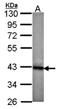 DNAJB2 Rabbit Polyclonal Antibody