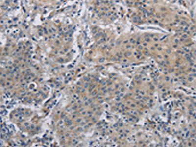 DNAJB4 Antibody