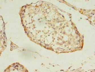 DNAJB5 Antibody