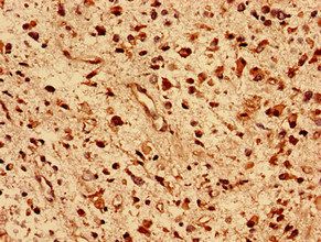 DNAJB5 Antibody
