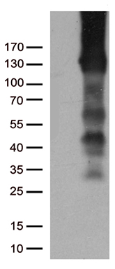 DNAJB6 Antibody