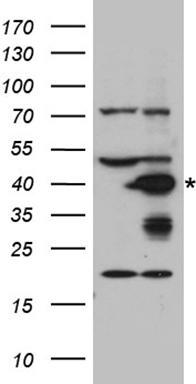 DNAJB6 Antibody