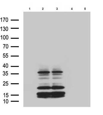 DNAJB6 Antibody