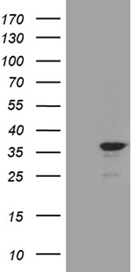 DNAJB6 Antibody
