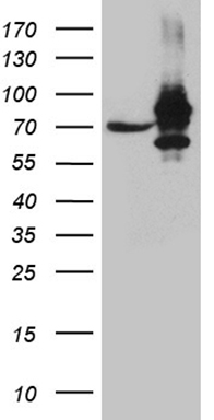 DNAJB6 Antibody