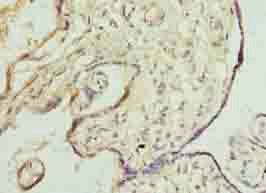 DNAJB8 Antibody