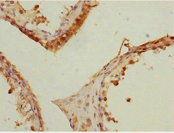 DNAJB9 Antibody