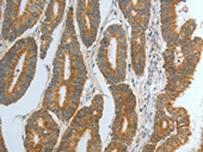 DNAJC10 Antibody