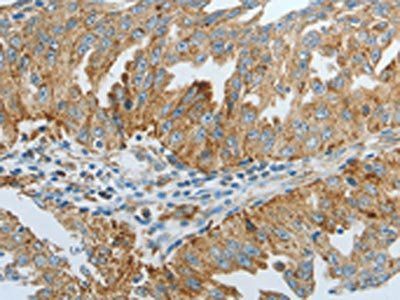 DNAJC10 Antibody