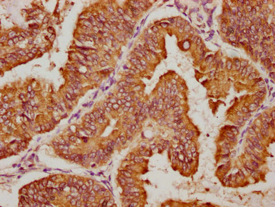 DNAJC10 Antibody