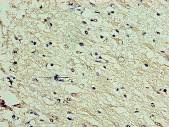 DNAJC30 Antibody