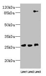 DNAJC30 antibody