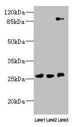 DNAJC30 Antibody