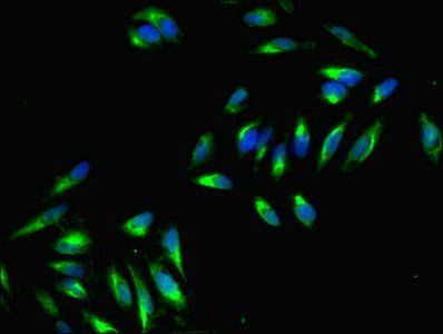 DNAJC6 Antibody