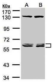 DNAJC7 antibody [N2C3]