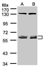 DNAJC7 antibody