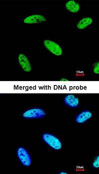 DNAJC7 antibody