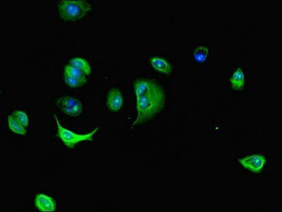 DNAL4 Antibody